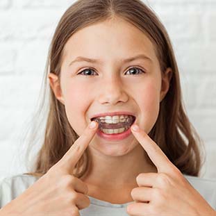 young girl pointing at her braces