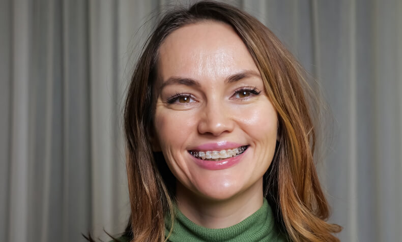 woman with ceramic braces