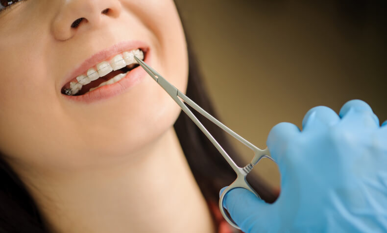 woman at the orthodontist